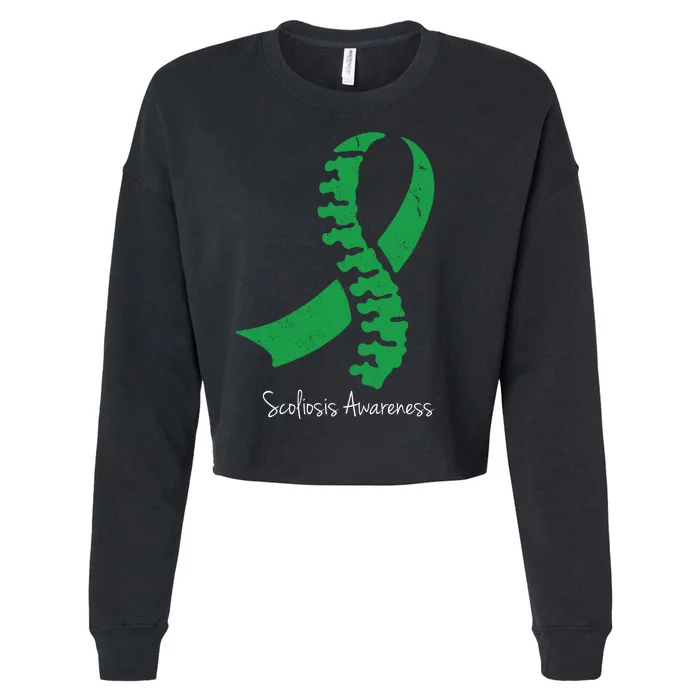 Scoliosis Awareness Cropped Pullover Crew