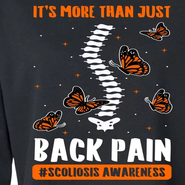 Scoliosis Awareness Spinal Deformity Orthopedic Scoliometer Cropped Pullover Crew