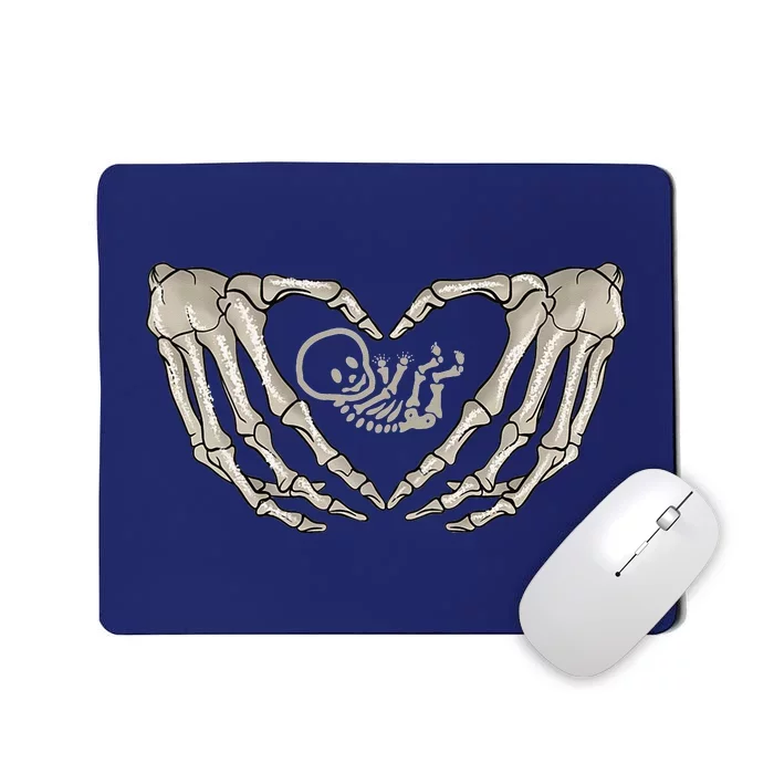 Skeleton Baby Pregnant Xray Skeleton Baby Mom Halloween Mousepad