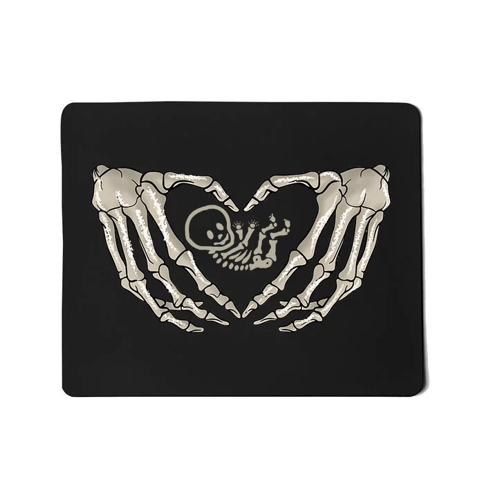 Skeleton Baby Pregnant Xray Skeleton Baby Mom Halloween Mousepad