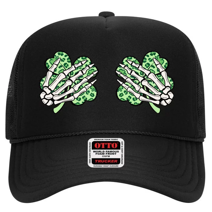 Skeleton Hands Lucky Shamrock Happy St Patricks Day High Crown Mesh Trucker Hat