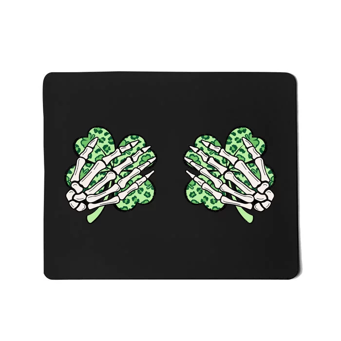 Skeleton Hands Lucky Shamrock Happy St Patricks Day Mousepad