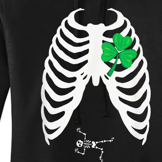 St Patricks Day Pregnancy Announcement Irish Baby Skeleton Women's Pullover Hoodie