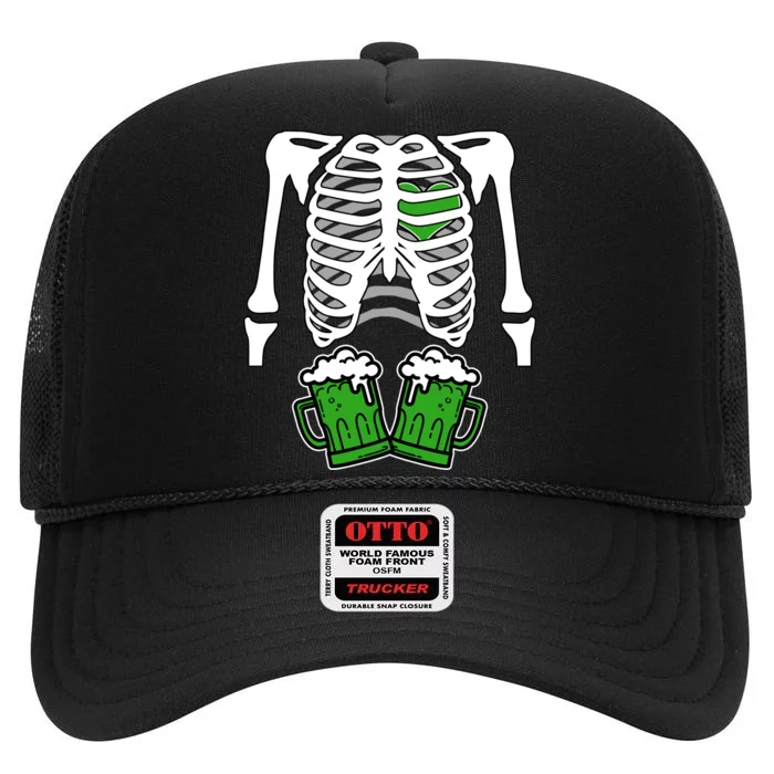 St. Patrick's Day Beer Rib Cage Skeleton High Crown Mesh Trucker Hat