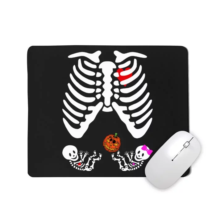 Skeleton Twins Girl Boy Pregnancy Halloween Costume Mousepad