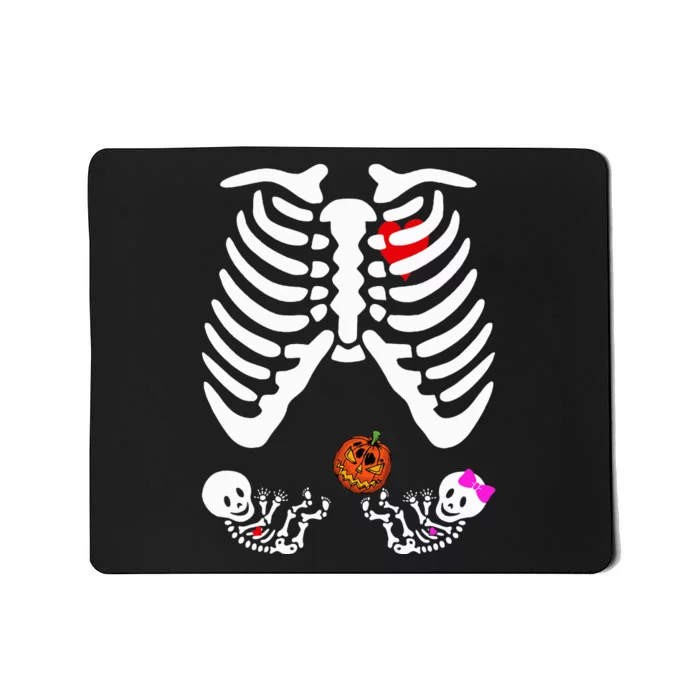 Skeleton Twins Girl Boy Pregnancy Halloween Costume Mousepad