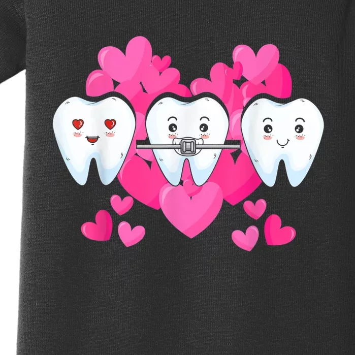 Tooth Fairy Valentine's Day Dentist Dear Dental Assistant Baby Bodysuit